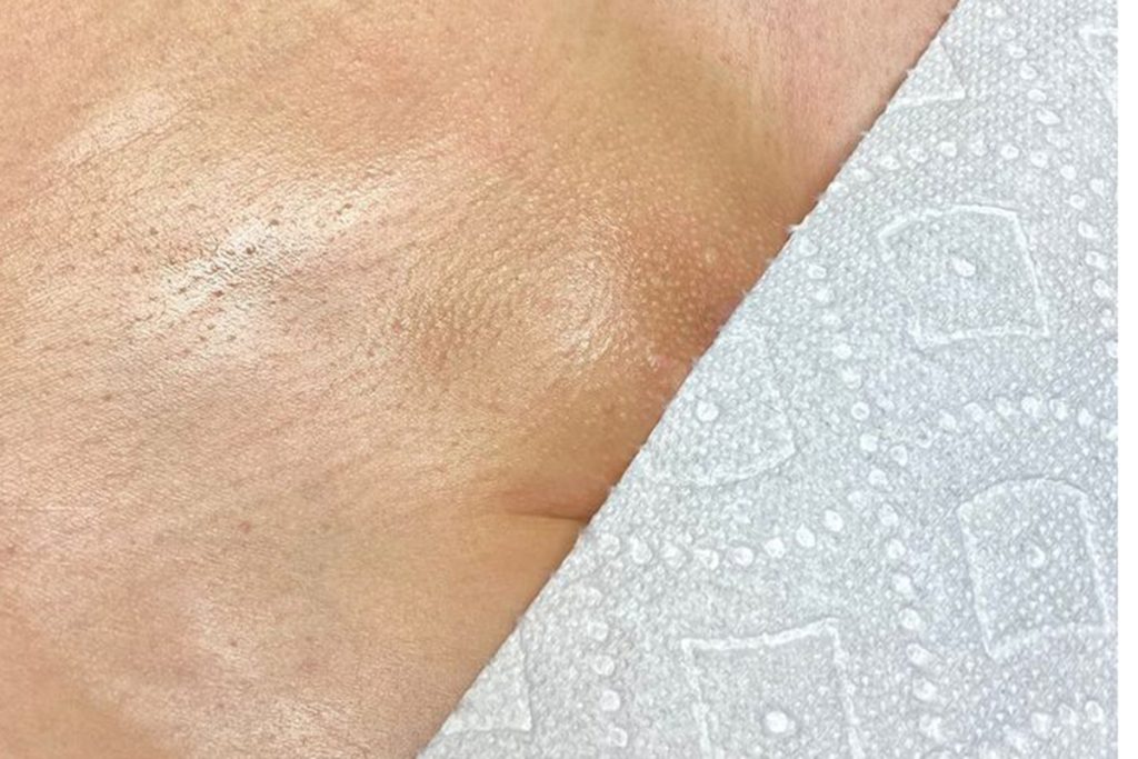 Brazilian Waxing