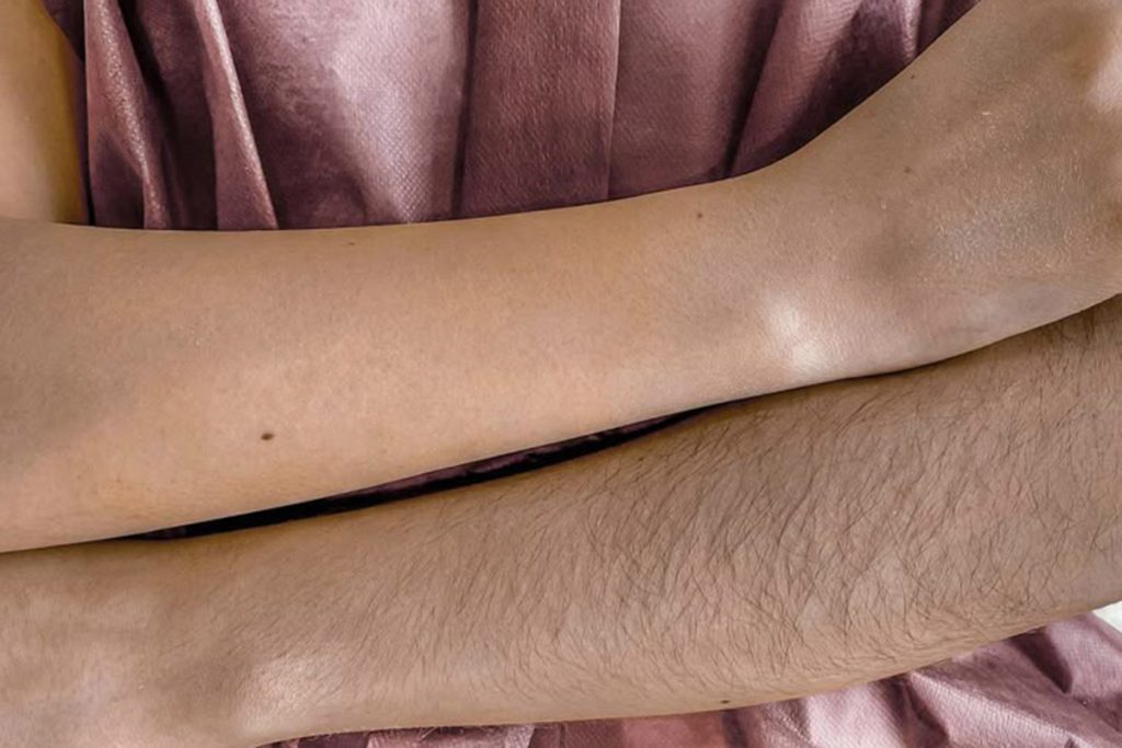 Full Arm Waxing